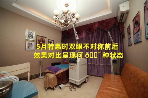 5月特惠时双眼不对称前后效果对比呈现何 🐯 种状态